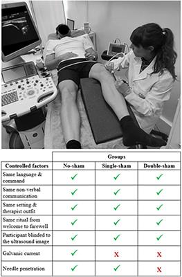 Placebo and nocebo effects of percutaneous needle electrolysis and dry-needling: an intra and inter-treatment sessions analysis of a three-arm randomized double-blinded controlled trial in patients with patellar tendinopathy